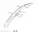 Fig. 12 - Transcoronary sinus pacing system, LV summit pacing, early mitral closure pacing, and methods therefor