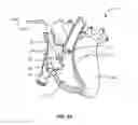 Fig. 13 - Transcoronary sinus pacing system, LV summit pacing, early mitral closure pacing, and methods therefor