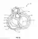 Fig. 15 - Transcoronary sinus pacing system, LV summit pacing, early mitral closure pacing, and methods therefor