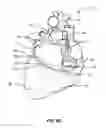 Fig. 16 - Transcoronary sinus pacing system, LV summit pacing, early mitral closure pacing, and methods therefor