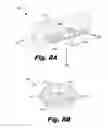 Fig. 15 - Thermoformed electrode arrays