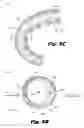 Fig. 17 - Thermoformed electrode arrays