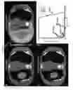 Fig. 03 - Arrays of accelerating structures and rapid imaging for facilitating rapid radiation therapies