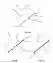 Fig. 14 - Systems and methods for use in emission guided radiation therapy