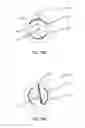 Fig. 29 - Systems and methods for use in emission guided radiation therapy