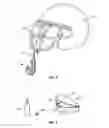 Fig. 03 - Mouth guard apparatus with hook