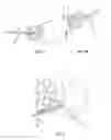 Fig. 03 - Auto reset zip line