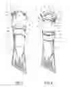 Fig. 02 - Strainer for a filling port