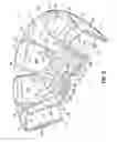 Fig. 07 - Fixed angle centrifuge rotor having torque transfer members