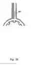 Fig. 11 - Forming a Metal Component