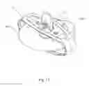 Fig. 16 - Cutter combination device for foodstuffs