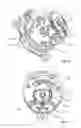 Fig. 07 - Adjuster device having a fixed element, an adjustable element and a first locking device