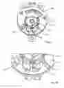 Fig. 09 - Adjuster device having a fixed element, an adjustable element and a first locking device