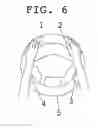 Fig. 07 - Steering wheel cover with inflatable hand-holds
