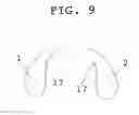 Fig. 10 - Steering wheel cover with inflatable hand-holds