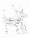 Fig. 05 - Vehicle body front portion structure