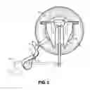 Fig. 03 - Anchoring apparatus