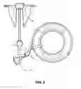 Fig. 04 - Anchoring apparatus