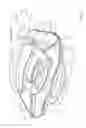 Fig. 12 - Encasement protective apparatus