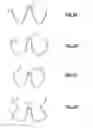 Fig. 03 - Three dimensional microstructures and fabrication process