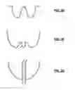 Fig. 06 - Three dimensional microstructures and fabrication process