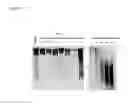 Fig. 06 - Dithiol mucolytic agents