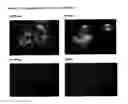 Fig. 06 - APPLICATIONS OF AN IMMUNE SYSTEM-RELEASED ACTIVATING AGENT (ISRAA)