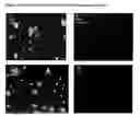Fig. 16 - APPLICATIONS OF AN IMMUNE SYSTEM-RELEASED ACTIVATING AGENT (ISRAA)