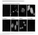 Fig. 20 - APPLICATIONS OF AN IMMUNE SYSTEM-RELEASED ACTIVATING AGENT (ISRAA)
