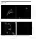 Fig. 27 - APPLICATIONS OF AN IMMUNE SYSTEM-RELEASED ACTIVATING AGENT (ISRAA)