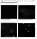 Fig. 28 - APPLICATIONS OF AN IMMUNE SYSTEM-RELEASED ACTIVATING AGENT (ISRAA)