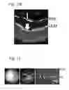 Fig. 13 - Recombinant AAV-crumbs homologue composition and methods for treating LCA-8 and progressive RP