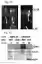 Fig. 14 - Recombinant AAV-crumbs homologue composition and methods for treating LCA-8 and progressive RP
