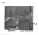 Fig. 02 - METHODS AND COMPOSITIONS FOR TREATMENT OF RETINOID-RESPONSIVE CONDITIONS