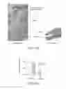 Fig. 20 - COMPOSITIONS AND METHODS FOR THE REMOVAL OF BIOFILMS