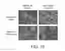 Fig. 31 - COMPOSITIONS AND METHODS FOR THE REMOVAL OF BIOFILMS