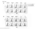 Fig. 29 - METHODS AND COMPOSITIONS FOR MODULATING VOLTAGE-GATED CALCIUM CHANNEL FUNCTION