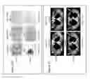 Fig. 15 - Compositions and methods for treatment of cancer