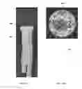 Fig. 22 - HIGHLY EXPANDABLE HYDROGELS IN MEDICAL DEVICE SEALING TECHNOLOGY