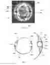 Fig. 24 - HIGHLY EXPANDABLE HYDROGELS IN MEDICAL DEVICE SEALING TECHNOLOGY