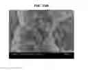 Fig. 15 - ALUMINUM-RESIN COMPOSITE AND METHOD FOR PRODUCING THE SAME