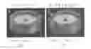 Fig. 02 - Perfusion bioreactor