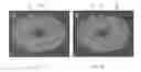 Fig. 05 - Perfusion bioreactor