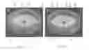 Fig. 11 - Perfusion bioreactor
