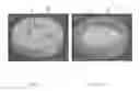 Fig. 14 - Perfusion bioreactor
