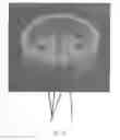 Fig. 22 - Perfusion bioreactor