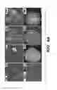 Fig. 12 - Compositions and methods for epithelial stem cell expansion and culture