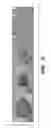 Fig. 17 - Compositions and methods for epithelial stem cell expansion and culture