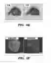 Fig. 21 - Compositions and methods for epithelial stem cell expansion and culture