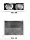 Fig. 35 - Compositions and methods for epithelial stem cell expansion and culture